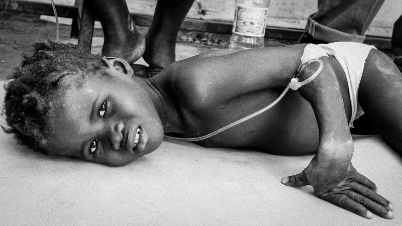 cholera haiti